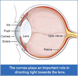 Cornea DSAEK Surgery